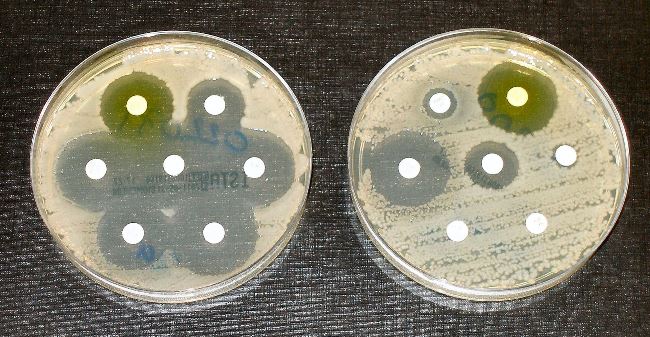 В поисках антибиотиков. Средство для борьбы с супербактериями найдено в пустыне