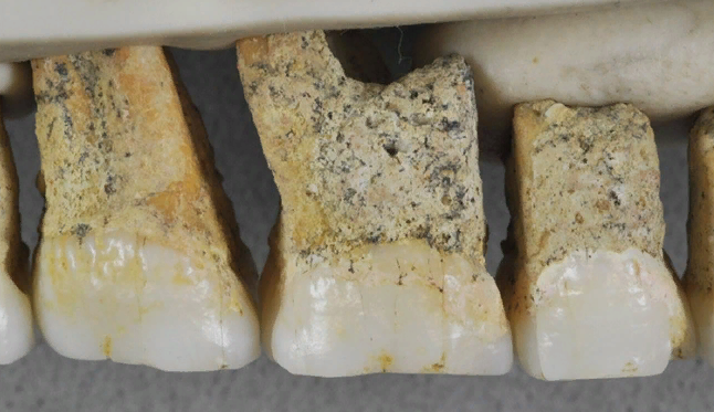 Зубы Homo luzonensis