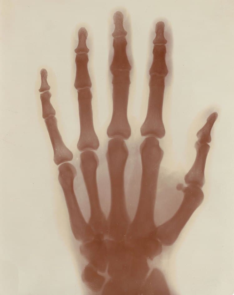tesla-hand-x-ray.jpeg