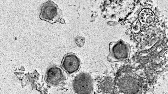 pandora-virus1.jpg