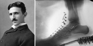 Никола Тесла сделал рентгеновский снимок ещё в 1896 году